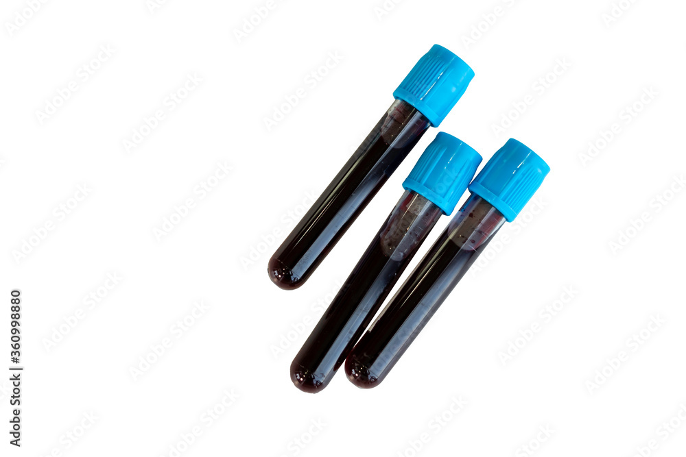 Test tubes and blood samples on white background with clipping path. Test tubes and blood samples on white background with clipping path.