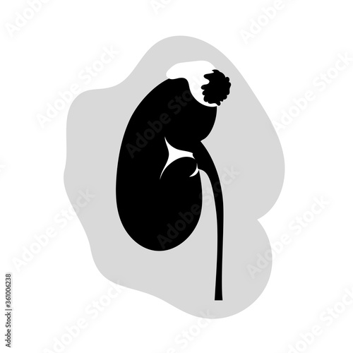 Adrenal gland tumor. Disease. Medical black and white anatomy illustration.