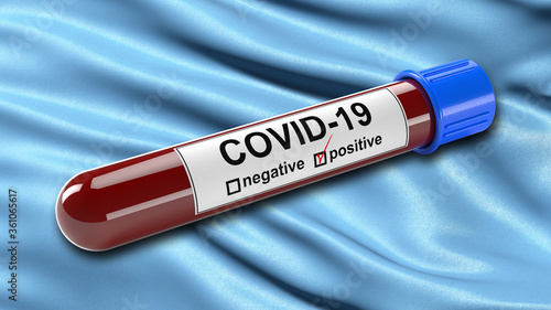 Flag of Cochabamba waving in the wind with a positive Covid-19 blood test tube. 3D illustration concept for blood testing for diagnosis of the new Corona virus.