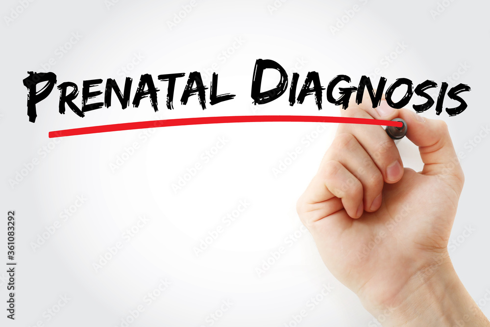 Fototapeta premium Prenatal Diagnosis text with marker, concept background