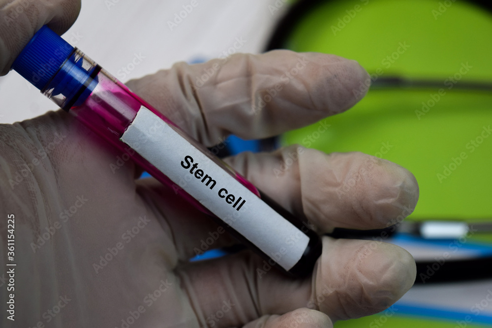 Stem Cell text with blood sample. Top view isolated on black background. Healthcare/Medical concept Stem Cell text with blood sample. Top view isolated on black background. Healthcare/Medical concept