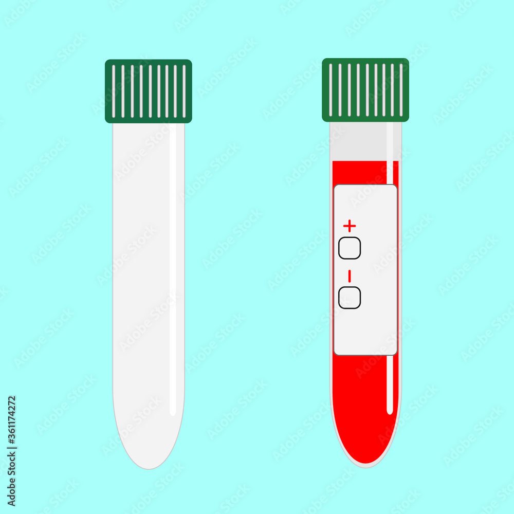 Blood filled test tube and empty glass test tube isolated on blue background. Vector illustration design. Blood filled test tube and empty glass test tube isolated on blue background. Vector illustration design.