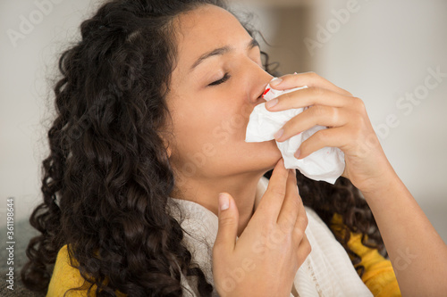 Obraz na płótnie young woman bleeding from her nose
