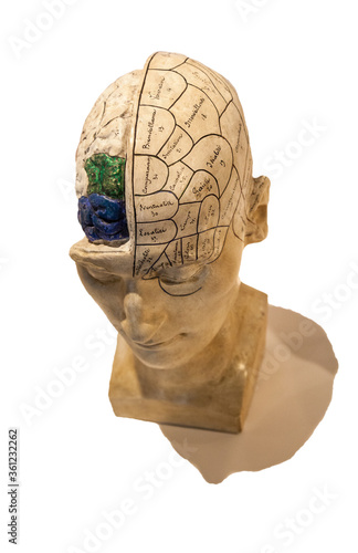 фотографія exposed brain