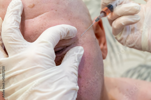 men's cosmetic operations. injections in the forehead to straighten out wrinkles, Botox