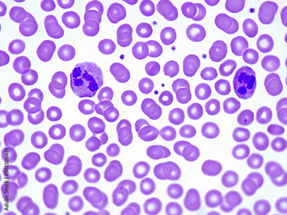 Two segmented neutrophil granulocytes in a blood smear under the microscope.  Stock Photo | Adobe Stock