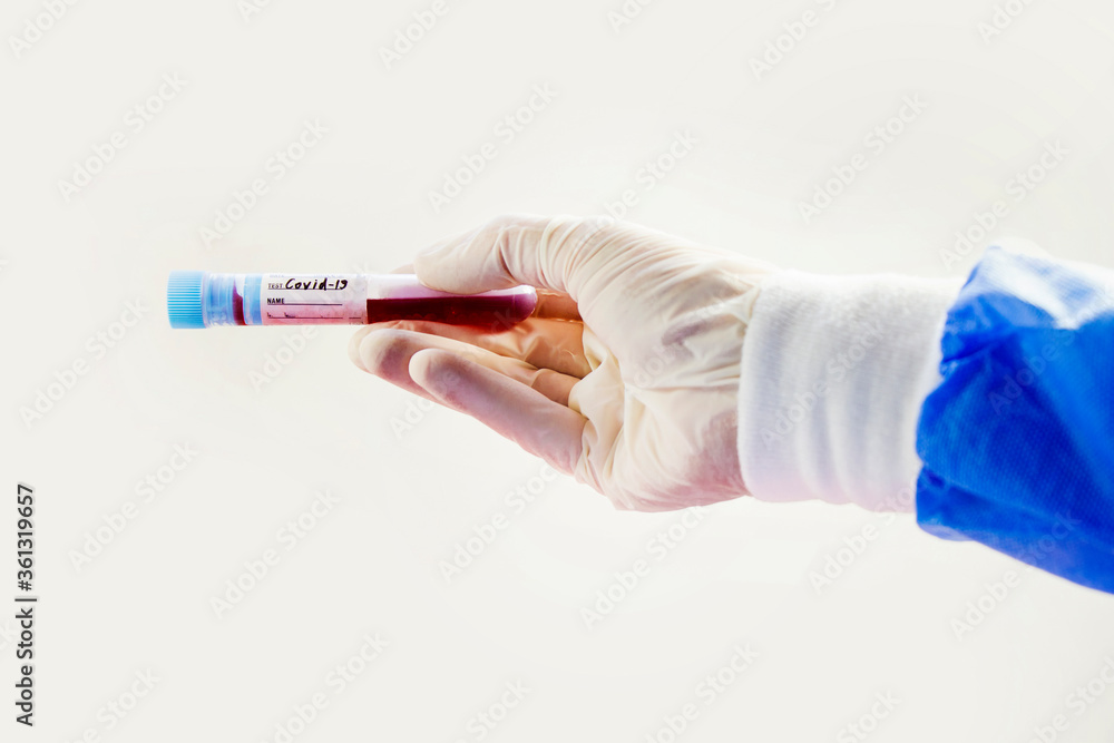 Corona virus test samples in doctor hand with gloves. Diagnosis and laboratory. Studio shoot, white background. Corona virus test samples in doctor hand with gloves. Diagnosis and laboratory. Studio shoot, white background.