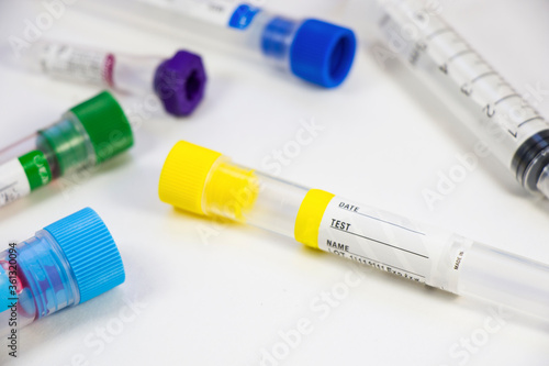 Blood test empty tubes samples on the white background  studio shoot.