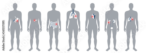 Pain in human body
