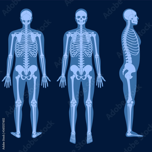 Skeleton x ray © pikovit