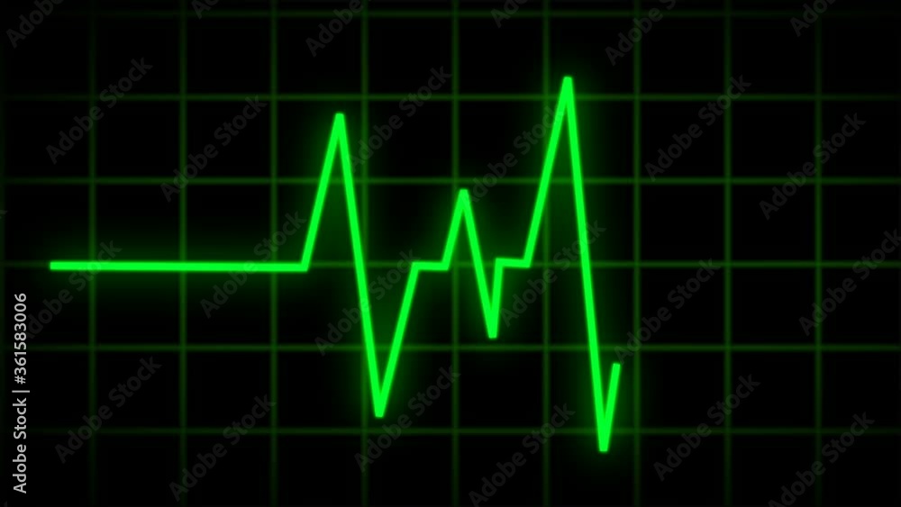 Heart-beating diagram moving like a green zigzag on a networked black screen Heart-beating diagram moving like a green zigzag on a networked black screen
