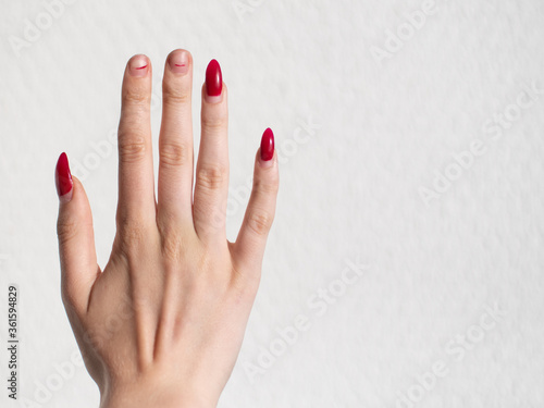 the hand of a young girl with two broken nails with a red manicure