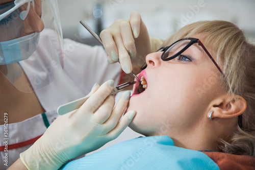 Closeup shot of dentist in protection mask working with tooth cavity and plague. Patient on stomatology chair repair aching teeth. Stomatologist and patient at clinic office. Toothcare concept