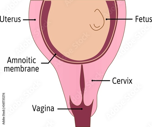 Cervix is not effaced. First stage of delivery process. cervix is tightly closed and protected. Medical vector illustration