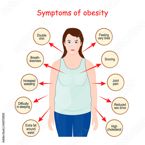 obesity sign and Symptoms