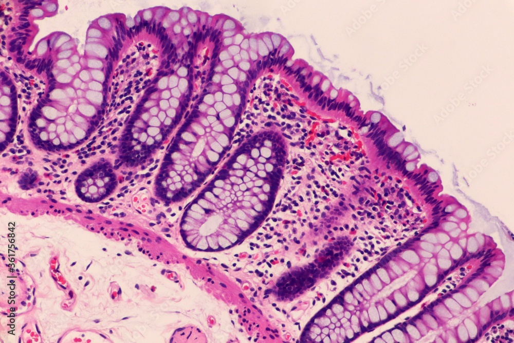 Obraz premium Mucosal lining of normal colon. Microscopic view.