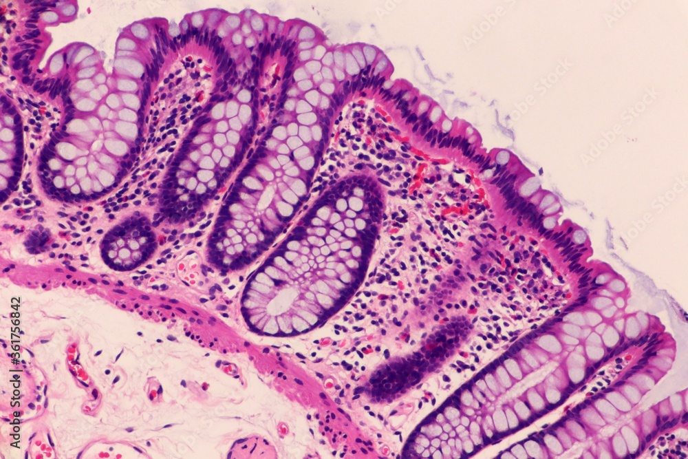 Mucosal lining of normal colon. Microscopic view.
