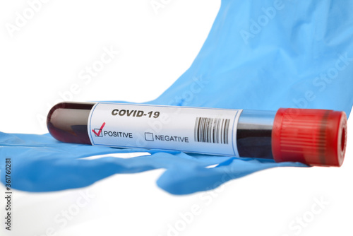 COVID-19 or Coronavirus Positive Blood Test     