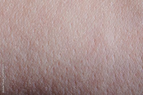 White human clean skin background