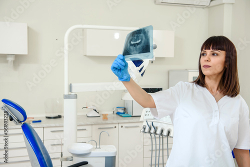 Young happy woman dentist holding a dental x-ray panoramic radiography and analyzing the future treatment in the dentistry.