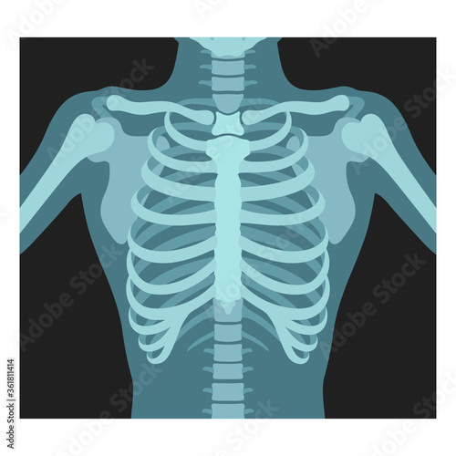 Thorax x-ray. Lungs radiological control. Radiography of chest, ribs., torso. Fluorography.