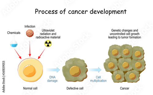 process of cancer cell development.