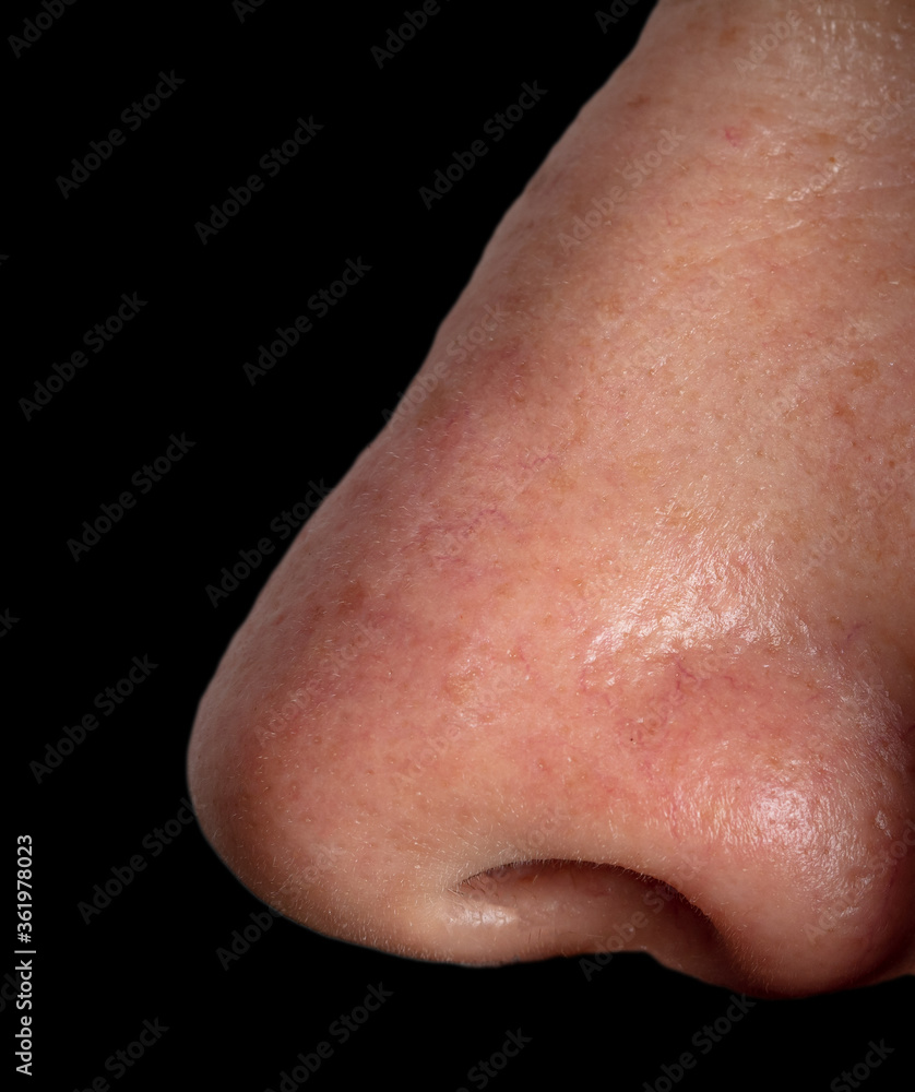 Close up of a man's nose isolated on a black background. Close up of a man's nose isolated on a black background.