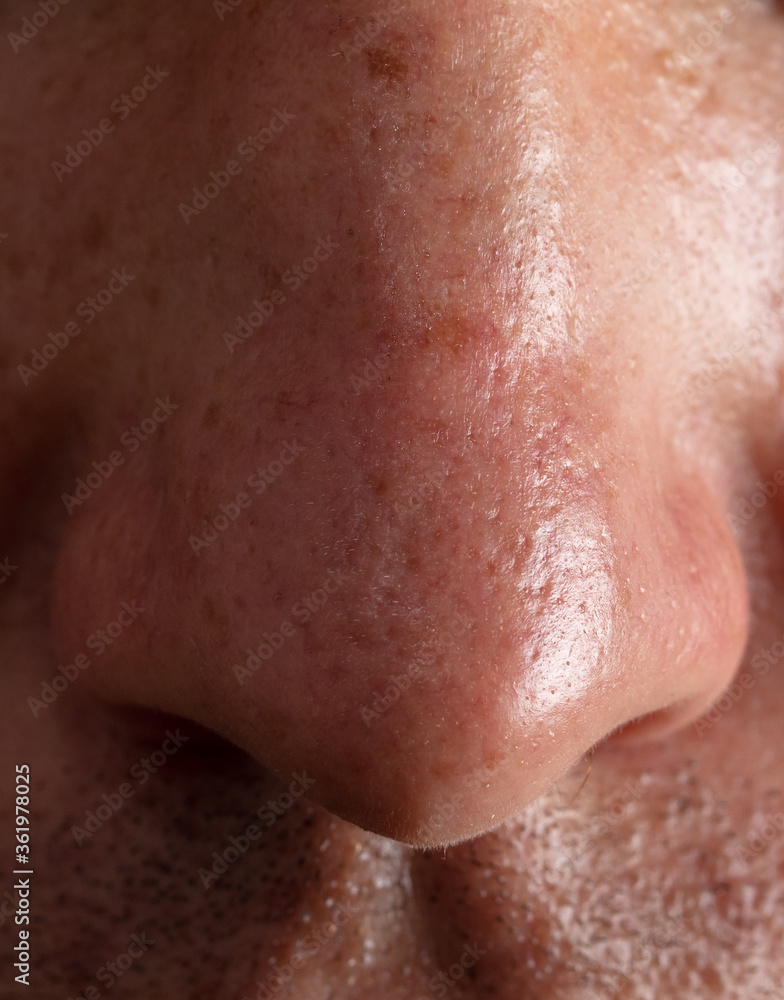 Close-up nose on the face of a man as a background. Close-up nose on the face of a man as a background.