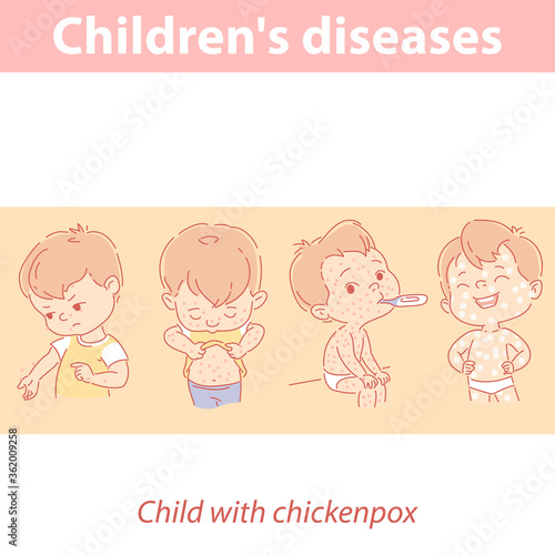 Children diseases. Baby with chicken pox set
