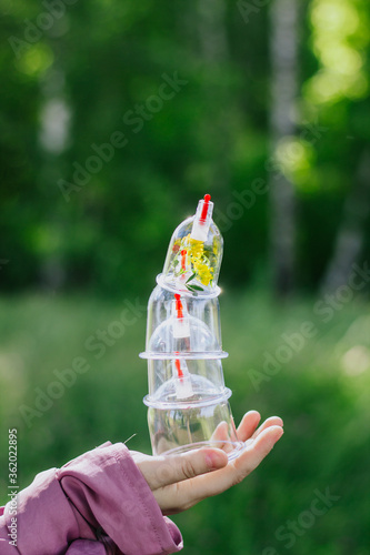 The girl holds a jar for a hijama and a flower in her hands. Yellow flowers. Hijama, bloodletting, treatment of sunna. Jars for bloodletting against the background of trees and greenery.