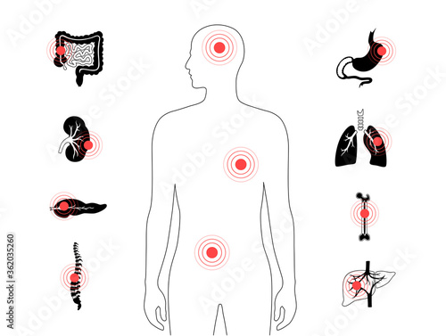 Pain in human body