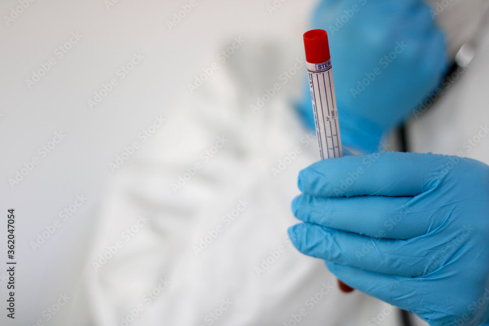 nCoV young doctor holds blood samples ready for analysis on dangerous coronavirus COVID 19 nCoV young doctor holds blood samples ready for analysis on dangerous coronavirus COVID 19