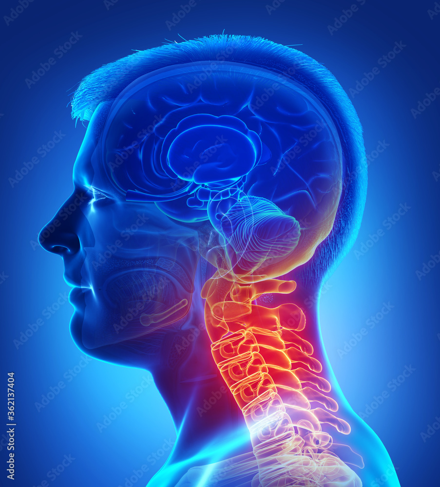3d rendered, medically accurate illustration of male having a painful neck 3d rendered, medically accurate illustration of male having a painful neck