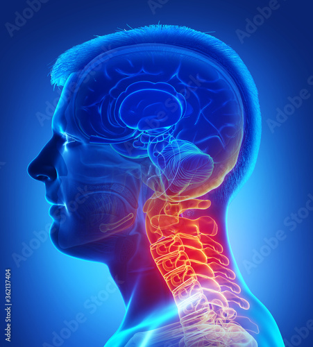 3d rendered, medically accurate illustration of male having a painful neck
