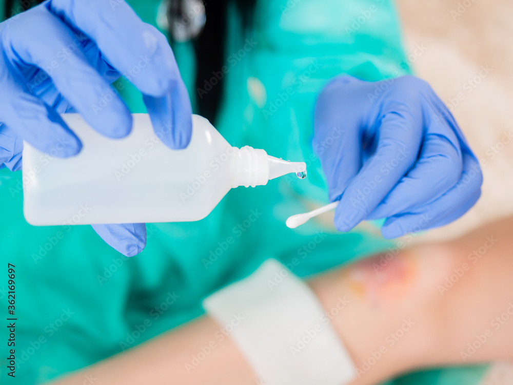 Close-up of a cotton swab and a bottle of antiseptic in the hands of a doctor against the background of a wound on the patient's leg. Close-up of a cotton swab and a bottle of antiseptic in the hands of a doctor against the background of a wound on the patient's leg.