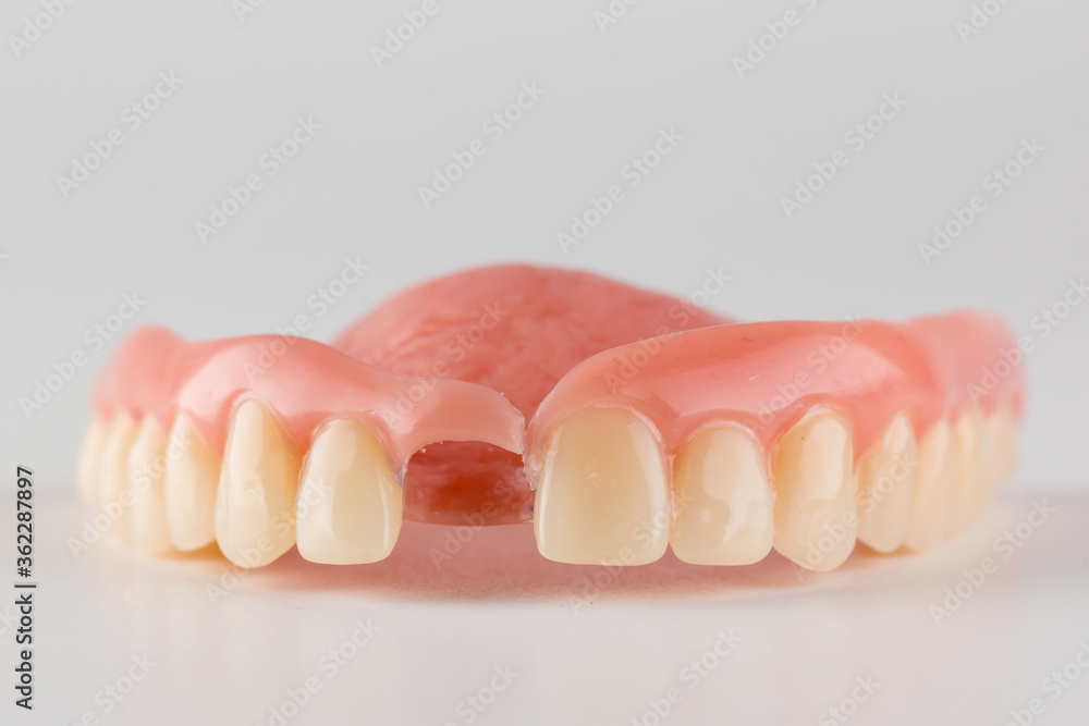 image of a modern denture nylone image of a modern denture nylone