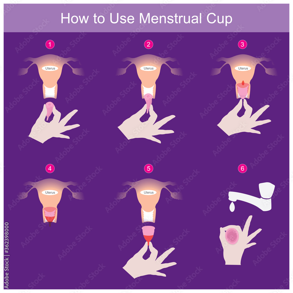 Vetor de How to Use Menstrual Cup. Illustration explain in use