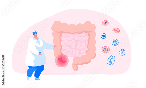 Abdominal Pain, Gastrointestinal System Disease. Doctor or Medic Character Stand at Huge Human Intestines with Sore Appendix Infographics Aid Decide Strategy of Treatment. Cartoon Vector Illustration