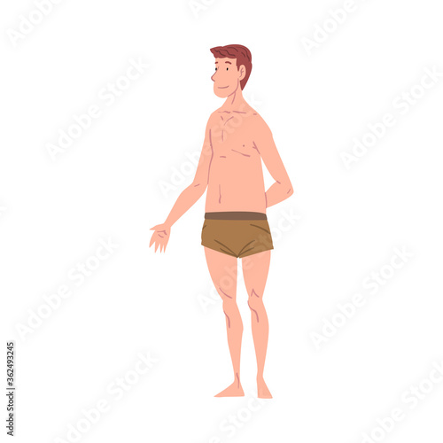 Overweight Man in Underwear, Male Mesomorph Body Type Cartoon Style Vector Illustration on White Background