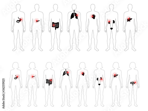Pain in human body