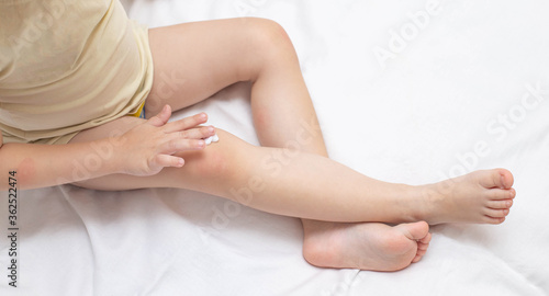 a small child rubs a children's healing cream on the skin of a knee. The concept of treatment of skin irritation, allergies and dry skin in children