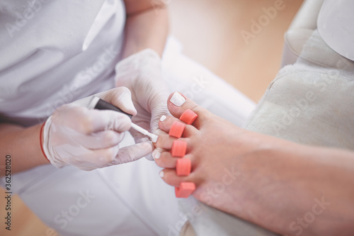 Pedicurist doing white nail polish on client legs using toe finger separator. Professional medical pedicure procedure. Foot treatment in SPA salon. Podiatry clinic. Beautician hands in white gloves.