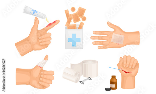 Hands with Injured Skin and Procedures of Bandaging and Wound Cleaning Vector Set