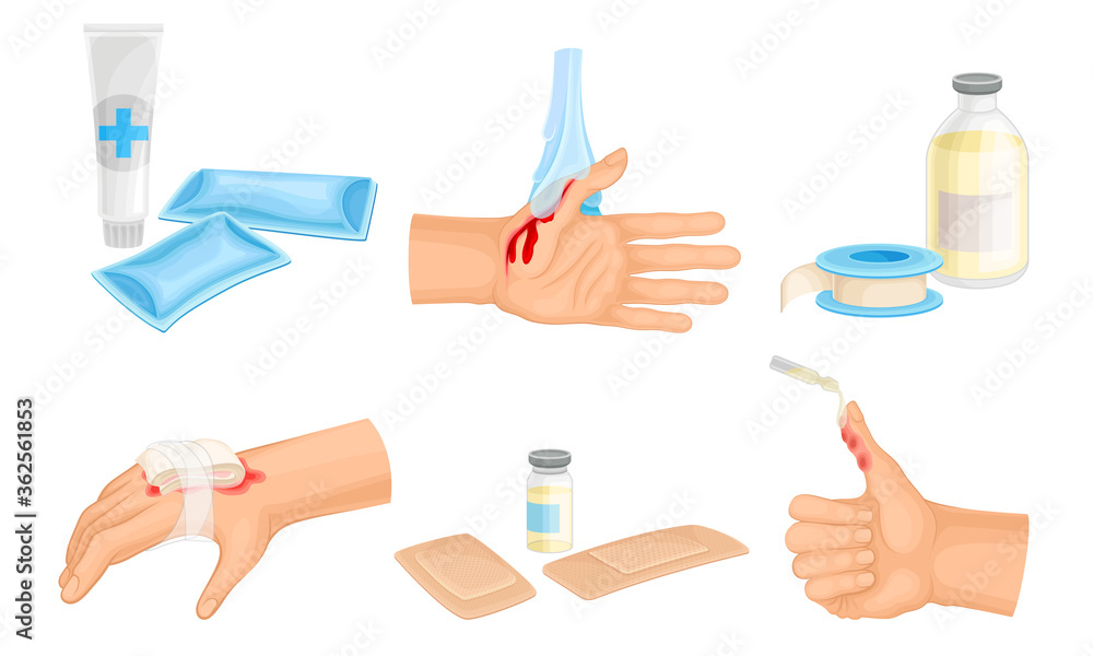Hands with Injured Skin and Procedures of Bandaging and Wound Cleaning Vector Set