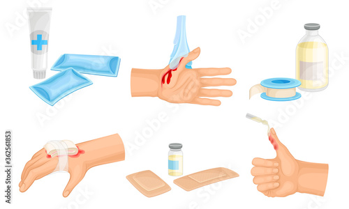 Hands with Injured Skin and Procedures of Bandaging and Wound Cleaning Vector Set