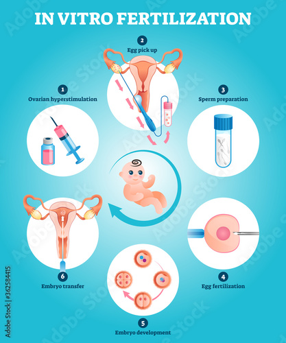 In Vitro fertilization artificial pregnancy reproduction vector illustration