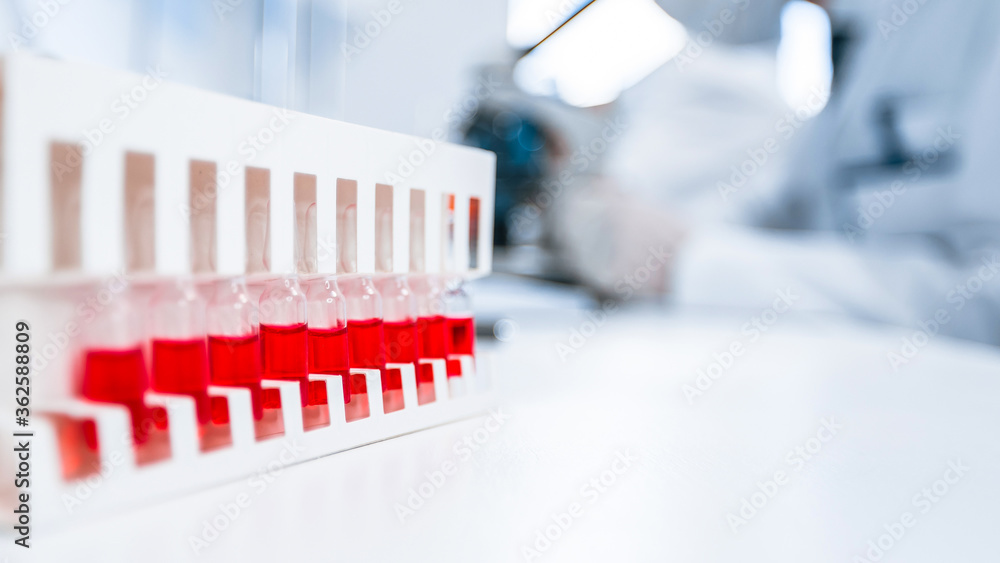 background image of a test tube with test results on a table in the laboratory .