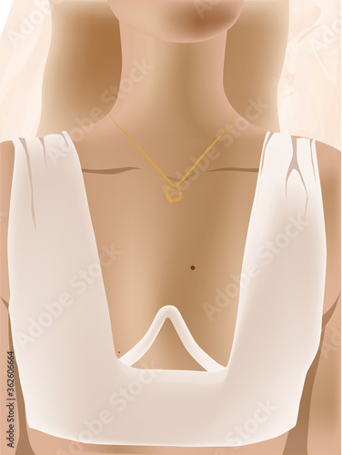Blonde woman in white top and gold necklace. Chest close-up. Moles on body