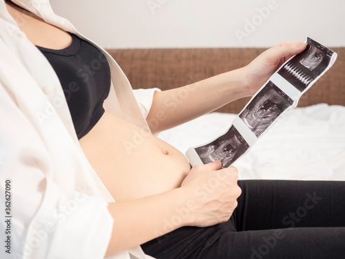 3 months pregnant Asian woman in white bed room, showing her ultrasound film. Woman touching her abdomen belly and looking at x-ray film.