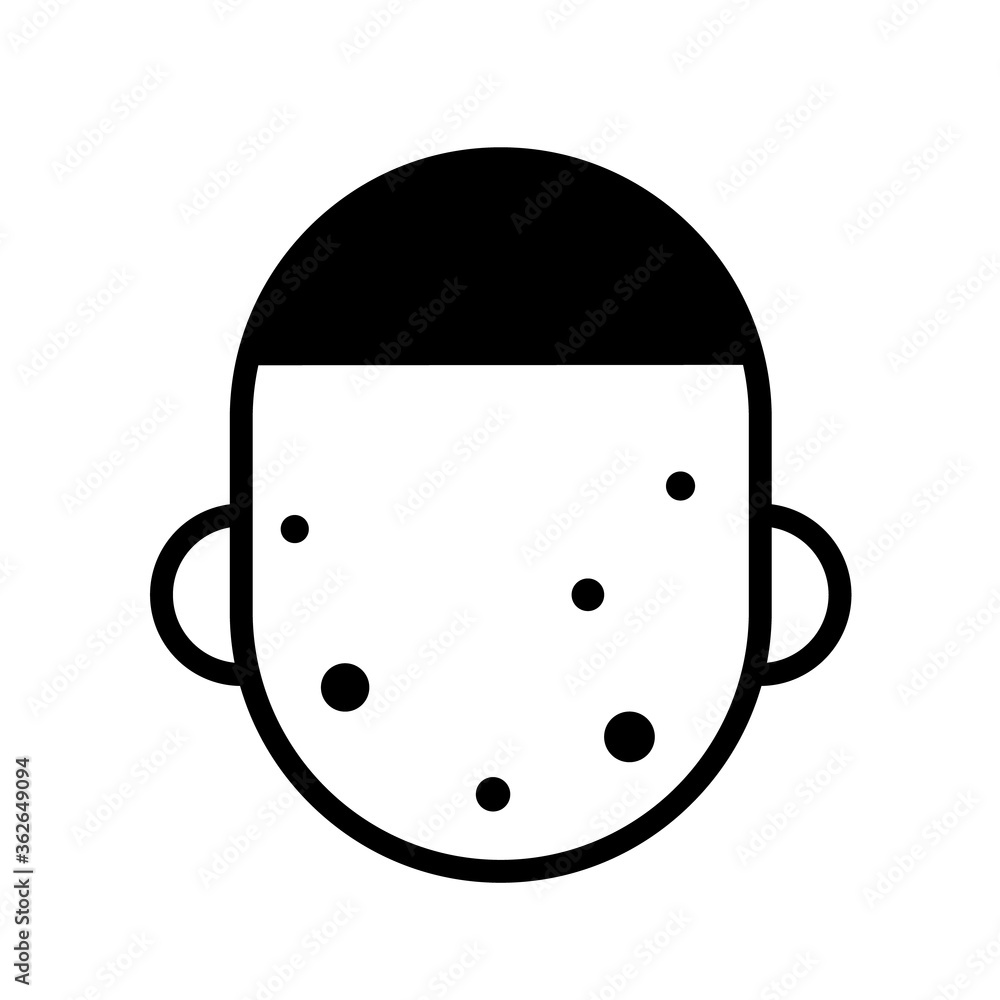 Man with acne or chicken pox, minimal black and white outline icon. Flat vector illustration. Isolated on white background. Man with acne or chicken pox, minimal black and white outline icon. Flat vector illustration. Isolated on white background.
